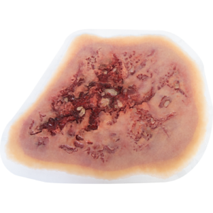 Self-Adhesive Wound: Torso Burn (Large)