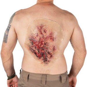 Techline Trauma Burn Torso Simulator Adhesive - Large