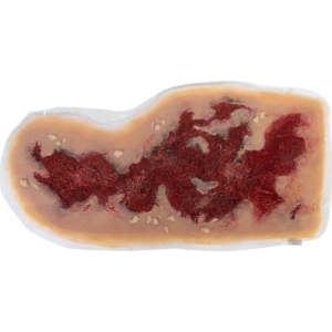 Self-Adhesive Wound: Chest Burn (Large)