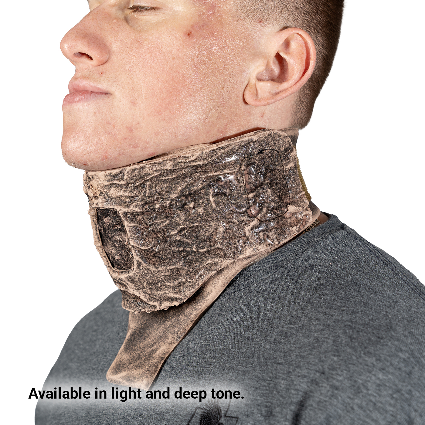 SMRT Trainer, Surgical Airway with Burns - Light Tone