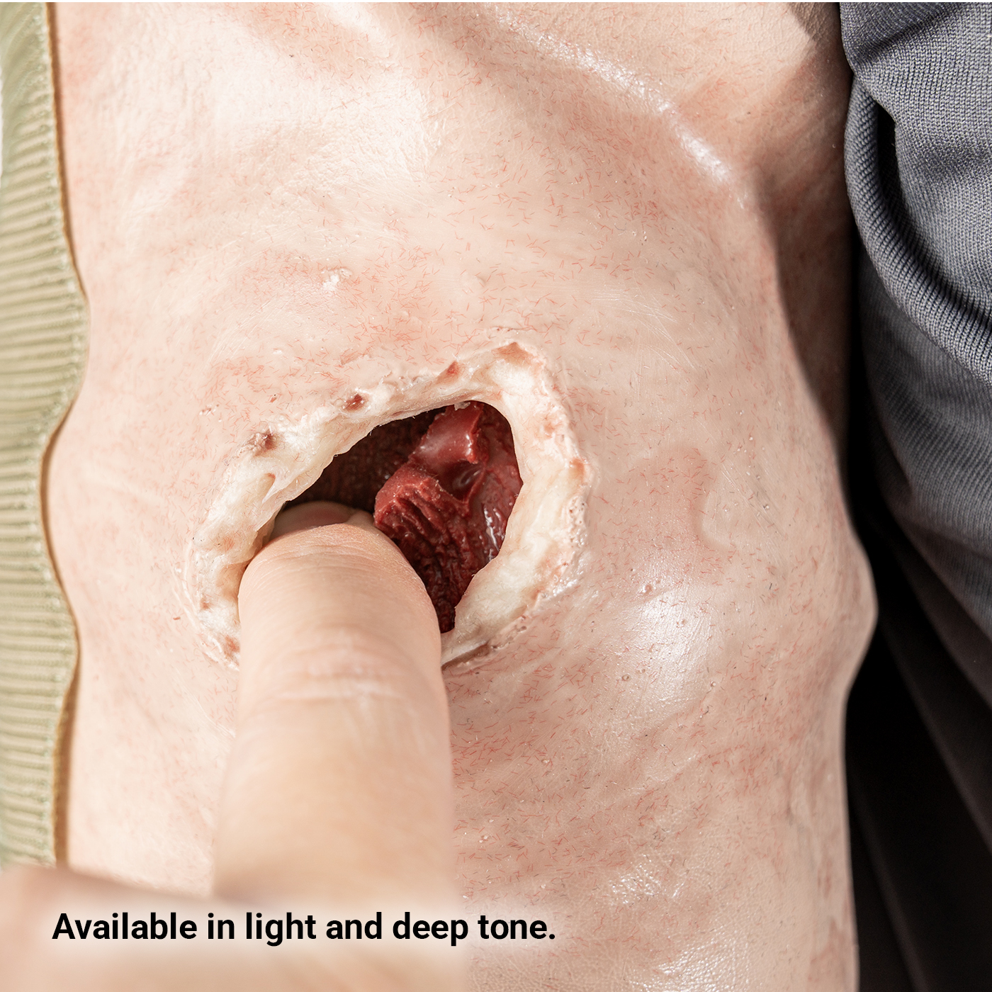 SMRT Trainer, Forearm with Gunshot Wound - Image 2