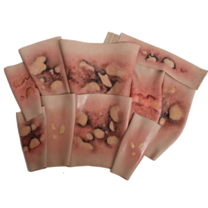SimBodies Burns & Blisters Sleeve Kit