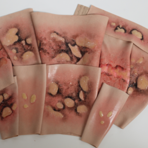 SimBodies Wearables, Burns & Blisters SIM-Sleeve Kit