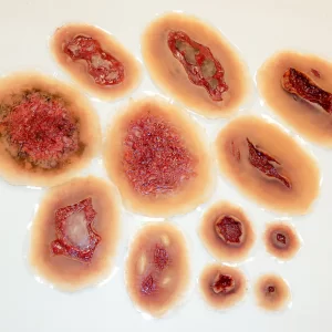 Self-Adhesive Wound Kit