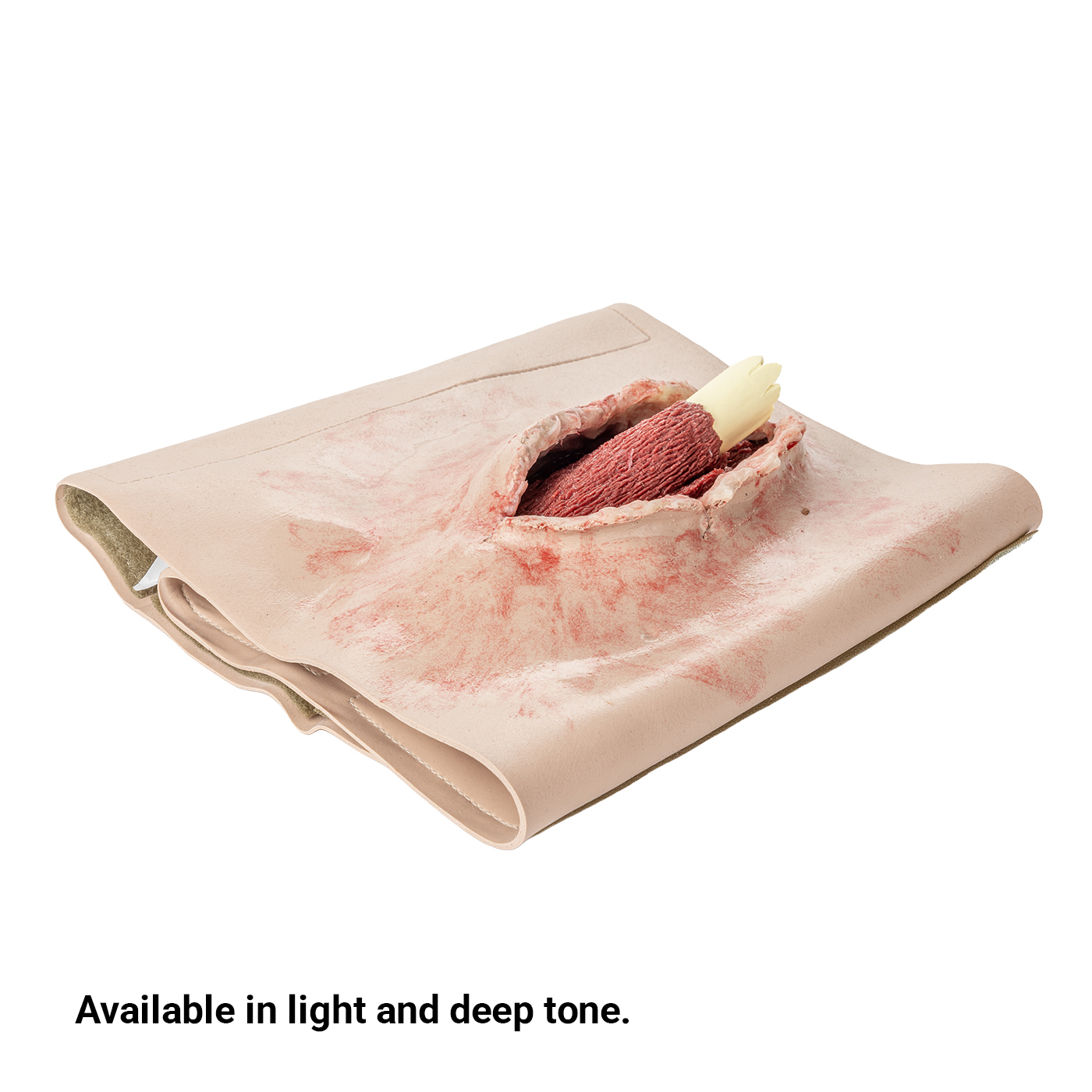 SMRT Trainer, Femur Fracture - Image 6