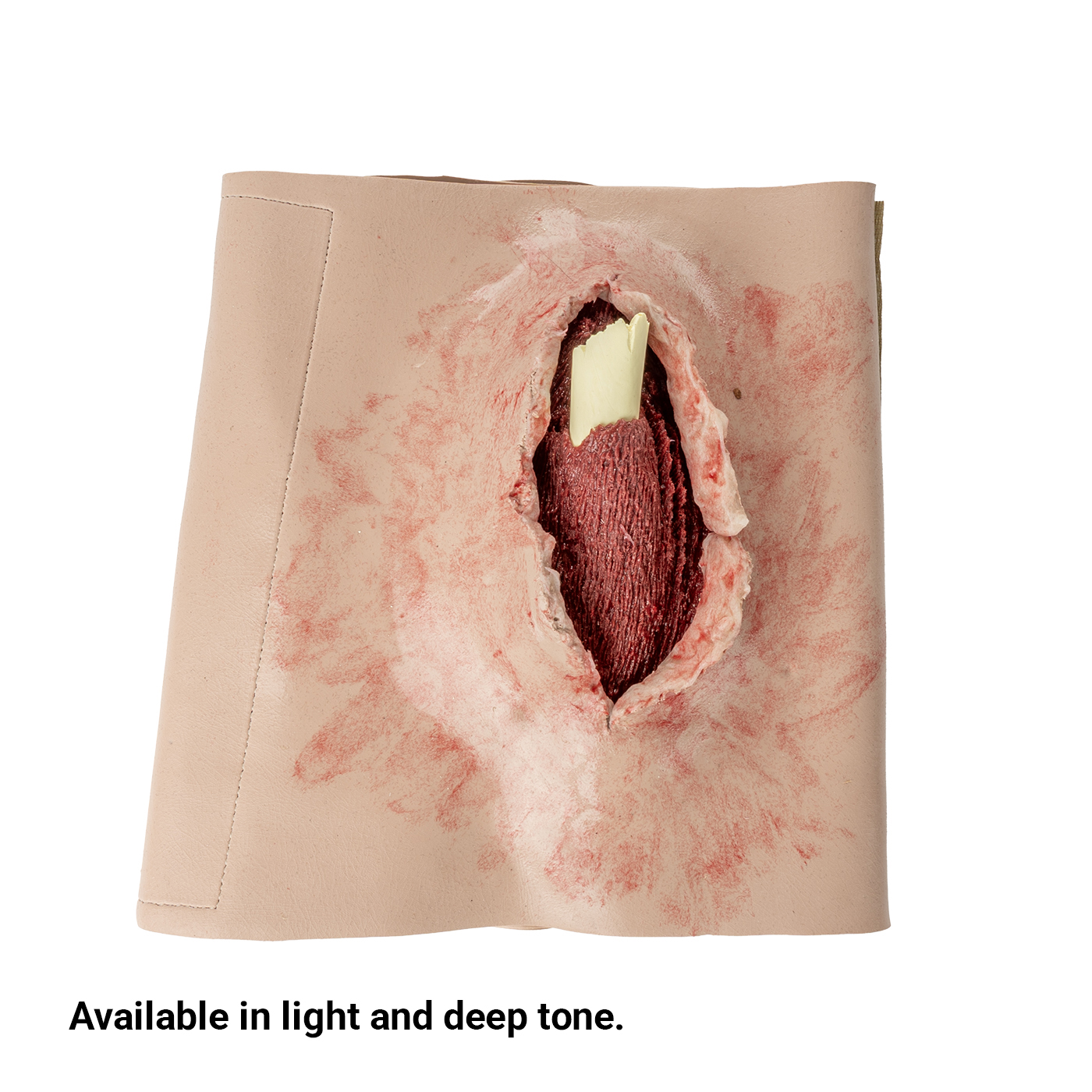 SMRT Trainer, Femur Fracture - Image 3