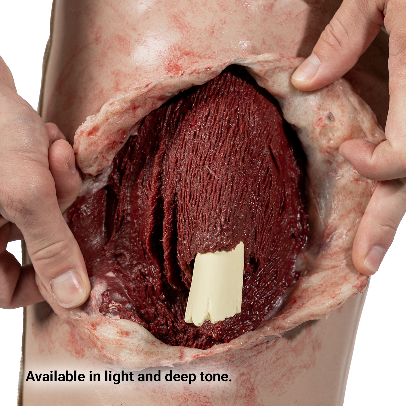 SMRT Trainer, Femur Fracture - Image 2