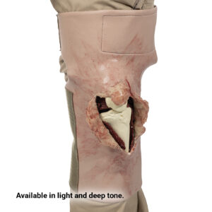SMRT Trainer, Knee Wound