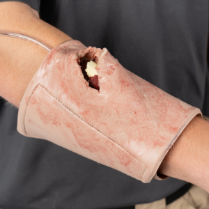 SMRT Trainer, Open Fracture; Versatile Placement
