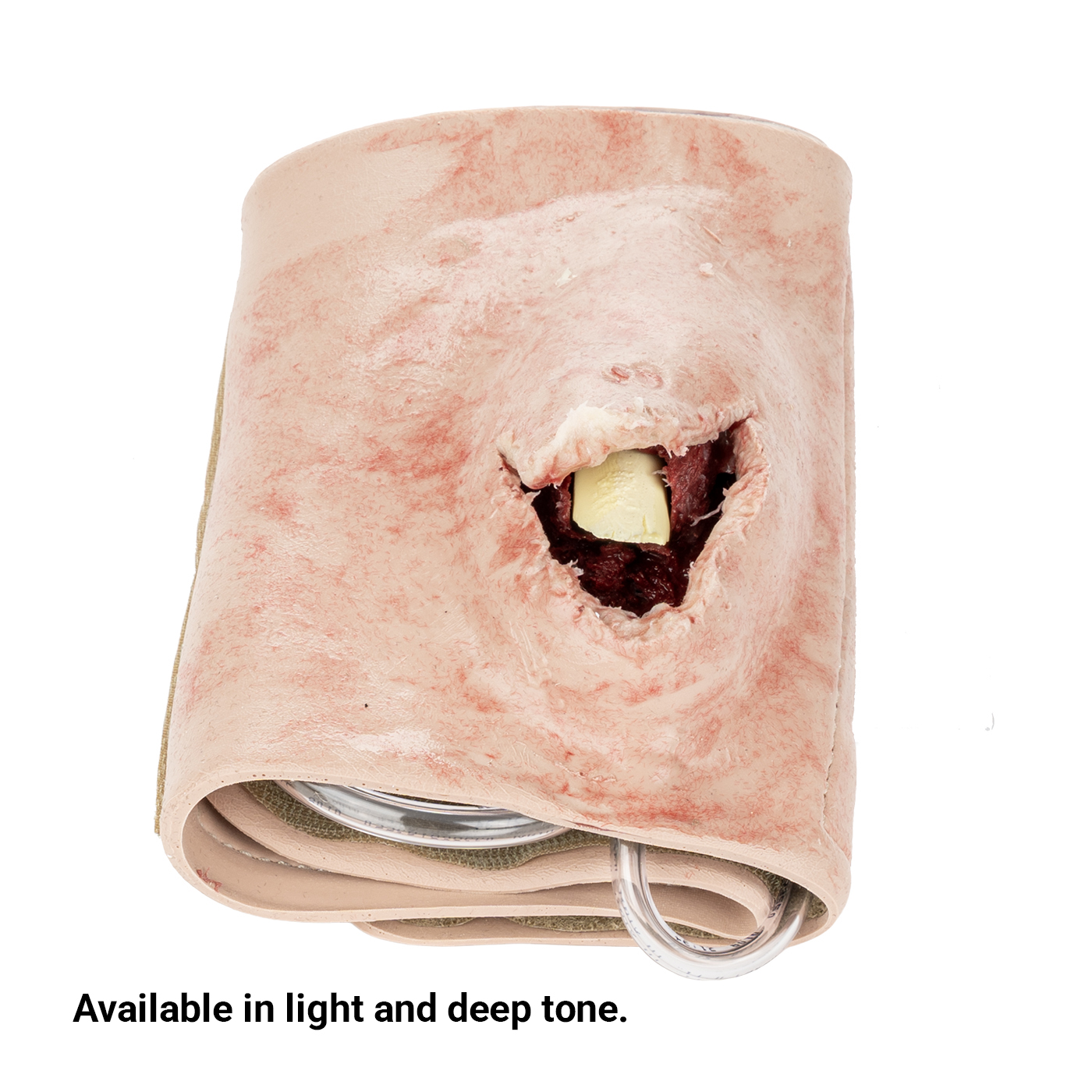 SMRT Trainer, Open Fracture; Versatile Placement - Image 2