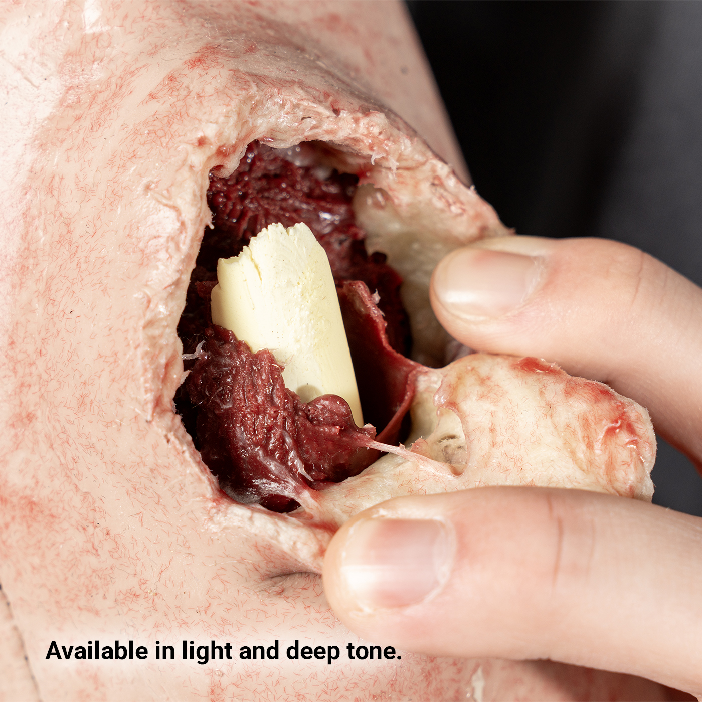SMRT Trainer, Open Fracture; Versatile Placement - Image 5