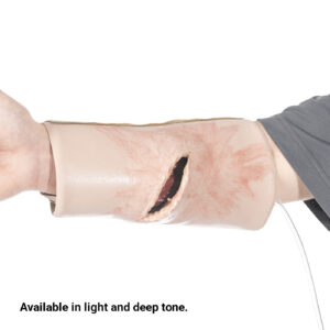 SMRT Trainer, Forearm Laceration