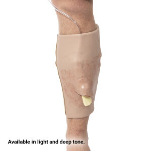 SMRT Trainer, Tibia Fracture (Distal Compound)