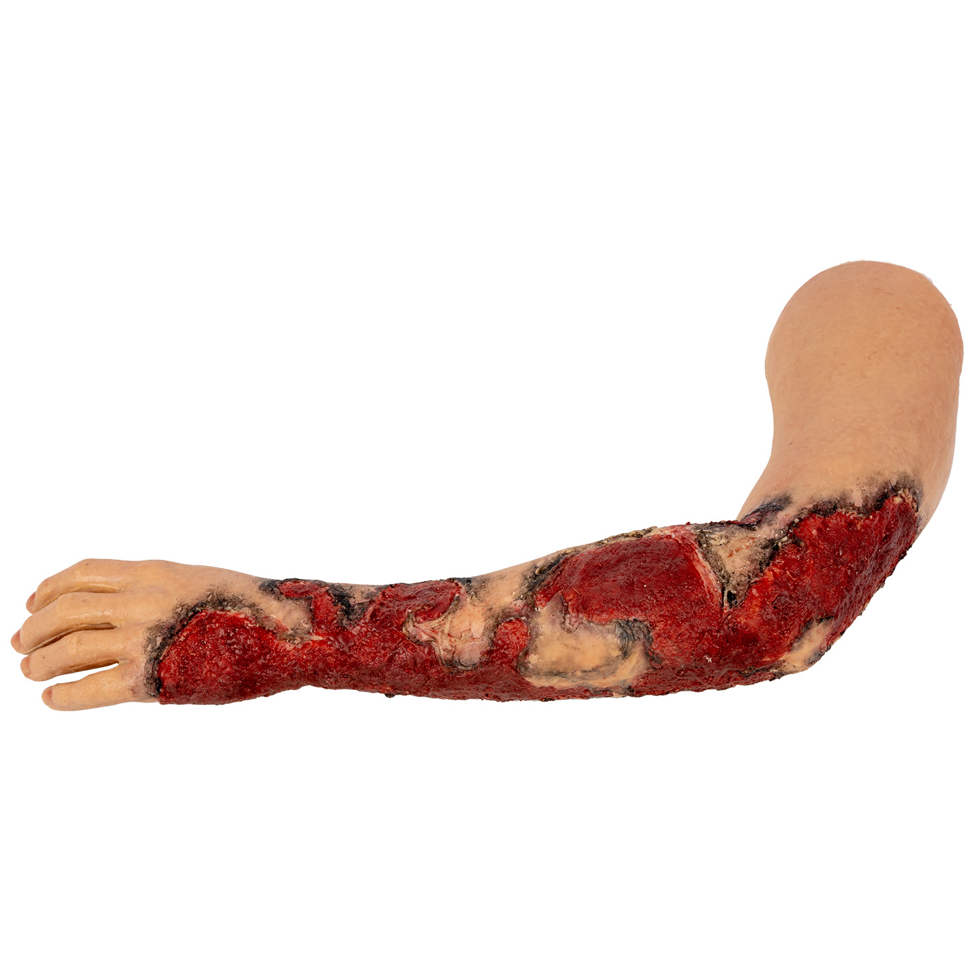 TOMManikin Left Arm with Burns